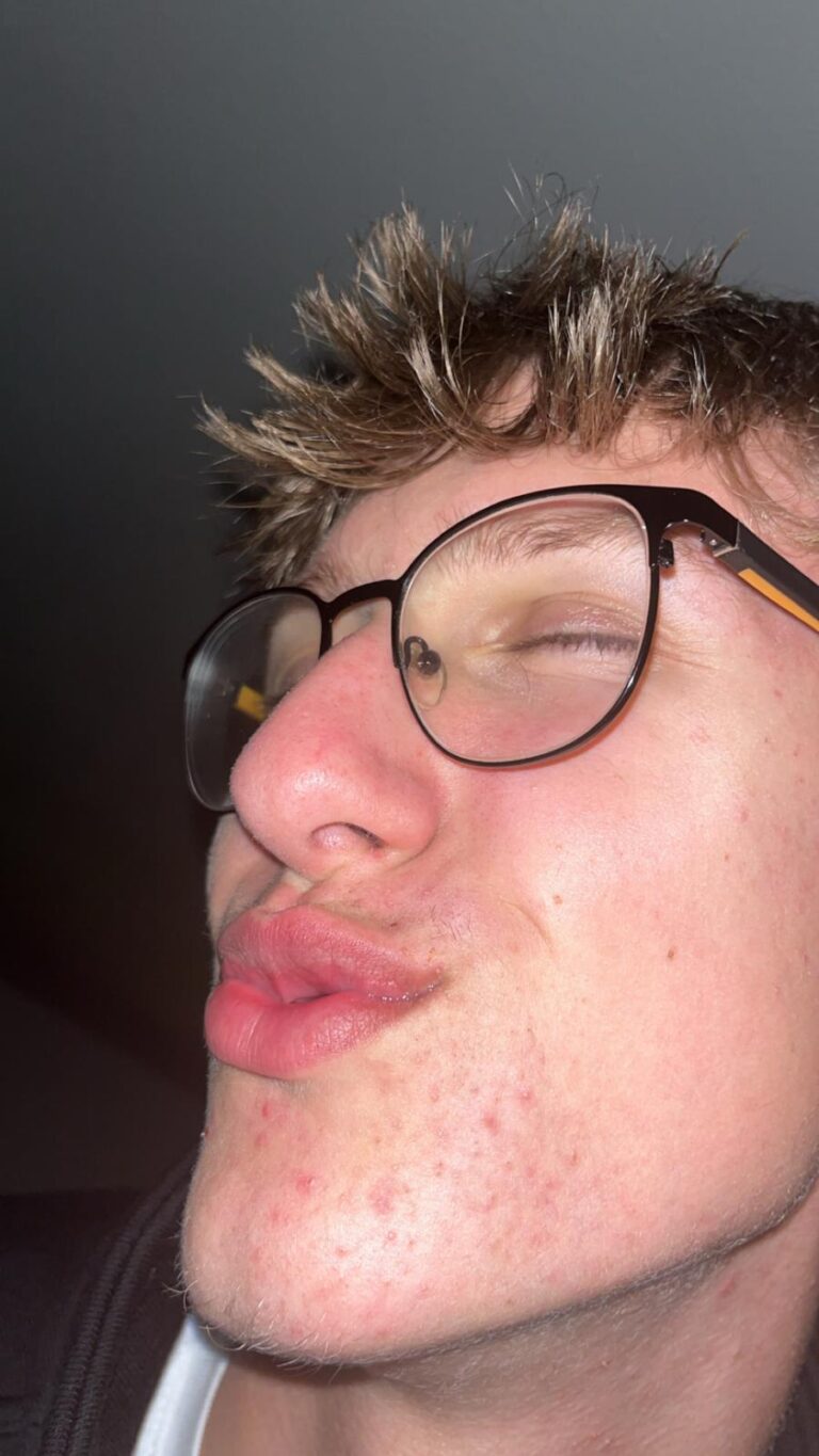 Der schlechte Küsser